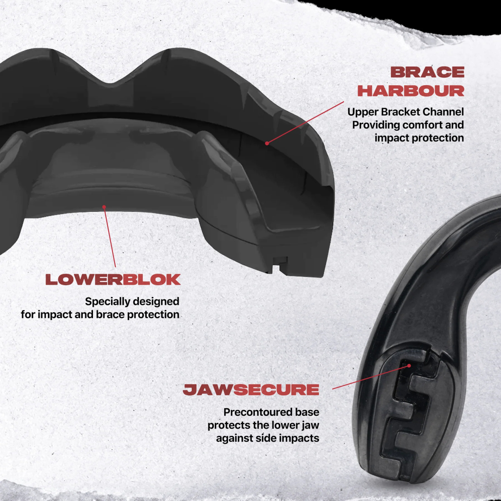 Капа SafeJawz Ortho Series для брекетов, чёрная