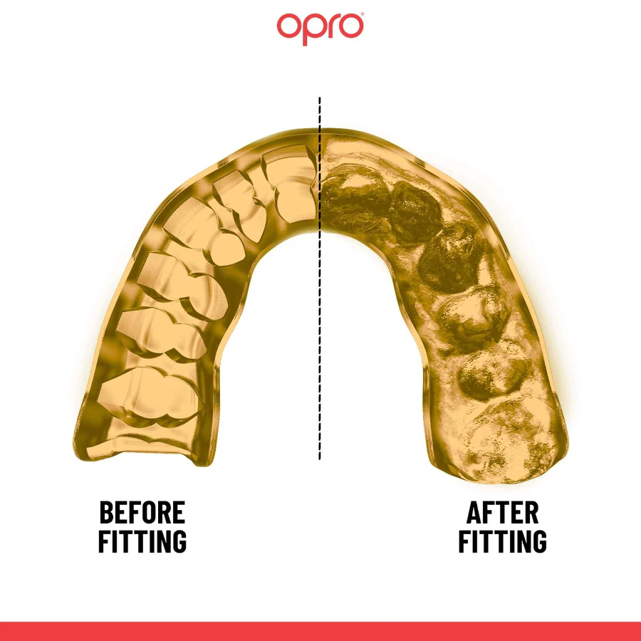 Капа мгновенной индивидуальной посадки Opro Custom-Fit, тёмно-синяя